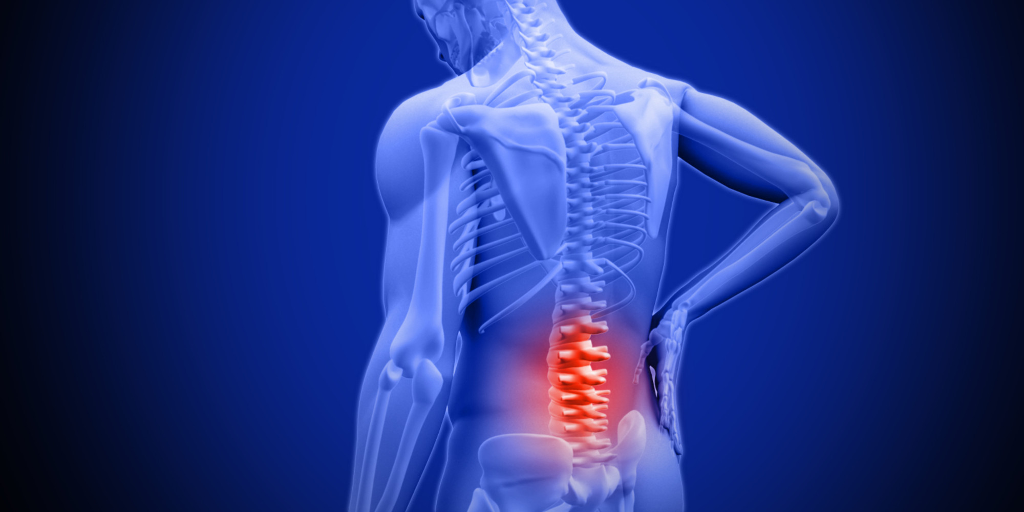 New Guidelines For Lower Back Pain Treatment South OC Chiropractic