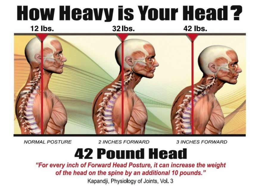 How to Fix Forward Head Posture (Text Neck) with One Daily Corrective  Routine